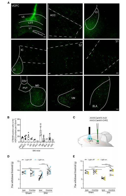 痛痛痛怎么辦 中山大學合作發現這條神經環路可緩解神經病理性痛